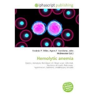  Hemolytic anemia (9786132731579): Books