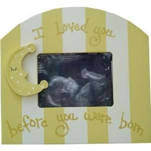  Sonogram Picture Frame in Yellow Baby