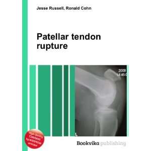  Patellar tendon rupture Ronald Cohn Jesse Russell Books