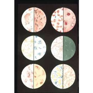 3B Scientific V2041U Bacteria Anatomical Chart, without Wooden Rods 