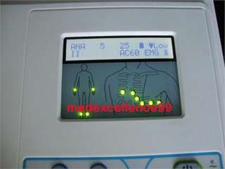 channel 12 lead EKG ECG machine Electrocardiograph  